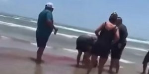 Επίθεση καρχαρία σε γυναίκα στο Τέξας