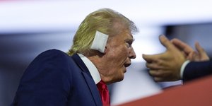 Ο Τραμπ με μπανταρισμένο αφτί