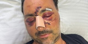 Ο Ελληνοκαναδός επιχειρηματίας που ξυλοκοπήθηκε στο Ηράκλειο