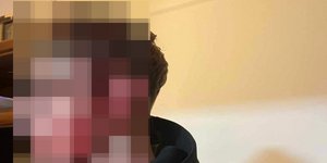 Επίθεση σε ανήλικους στη Θεσσαλονίκη: «Μέσα στα αίματα, τους χτύπησαν με σίδερο» -Σοκάρει η εικόνα με τα τραύματα