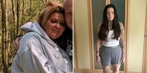 Η Βρετανίδα πριν πάει στην Τουρκία για επέμβαση απώλειας βάρους και πώς είναι σήμερα