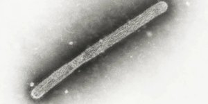 Ιός Η5Ν1 της γρίπης των πτηνών σε ηλεκτρονικό μικροσκόπιο