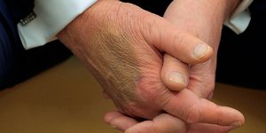 Ντόναλντ Τραμπ