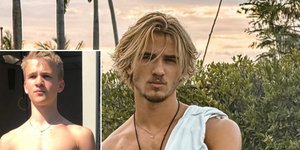 Η αδιανόητη μεταμόρφωση ενός influencer χωρίς αισθητικές επεμβάσεις/Φωτογραφίες: Instagram/babystickley
