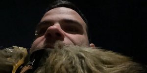 Ο «Youtuber» Teosty μετά την επίθεση με αυγό που δέχτηκε