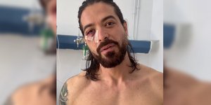 Άρης Μουγκοπέτρος