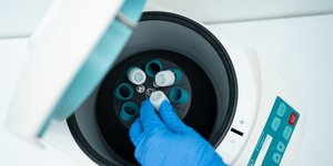 εξωσωματική γονιμοποίηση