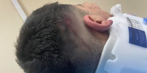 Οδηγός μηχανής μετά από τροχαίο