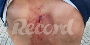 Μαχαίρωσαν στην πλάτη οπαδό της Σπόρτινγκ Λισαβόνας