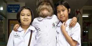 Το πιο τριχωτό κορίτσι στον κόσμο έχει αλλάξει πολύ