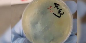 Η Κινέζα ερευνήτρια έστειλε τέσσερα πακέτα με τοξικά παράσιτα σε γνωστούς της σε εργαστήριο του Πανεπιστημίου του Μίσιγκαν