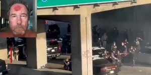 Λος Άντζελες: Αστυνομικός πυροβόλησε με πλαστική σφαίρα φωτογράφο στο κεφάλι 