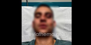 ξυλοδαρμός
