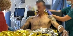 Χανιά: Σοκαριστικός τραυματισμός του πρωταθλητή ποδηλασίας Γιάννη Ζεντέλη – Έπεσε σε λακούβα