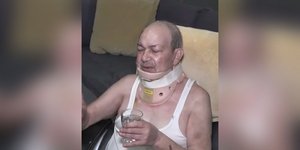 Θύμα άγριας ληστείας 71χρονος καρκινοπαθής