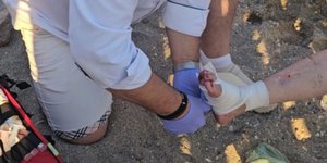 Η γυναίκα που τραυματίστηκε, έπειτα από επίθεση θαλάσσιας χελώνας