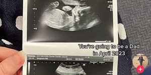 Το υπερηχογράφημα που πόσταρε η Βρετανή ψάχνοντας τον άνδρα που γνώρισε στην Τενερίφη