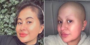 H 29χρονη έγκυος από την Βρετανία που μπέρδεψε τα συμπτώματα του καρκίνου με αυτά της εγκυμοσύνης