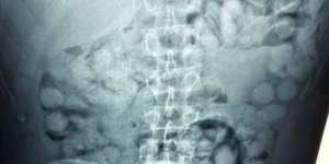 Photo from the stomach of the man arrested