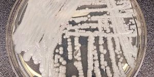 Καλλιέργεια στελέχους του μύκητα Candida auris 