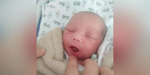 Μωρό στην Βραζιλία γεννήθηκε με δύο δόντια