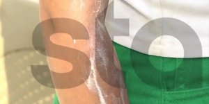 Σεπόλια ανήλικη