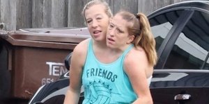 Οι σιαμαίες αδελφές 