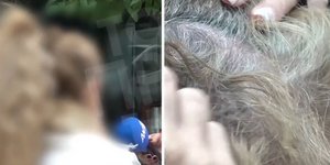 Η 43χρονη, θύμα ξυλοδαρμού στη μέση του δρόμου 