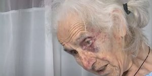 Η ηλικιωμένη γυναίκα που έπεσε θύμα ληστείας στο Αγγελόκαστρο Αιτωλοακαρνανίας