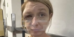 Η σοκαριστική εικόνα της γυναίκας που ξυλοκόπησε ο σύζυγός της στο Κορωπί