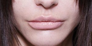 Πώς να αποκτήσετε βελούδινα, ζουμερά χείλη χωρίς ενέσεις