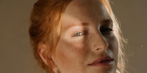 Τα δύο φαγητά που κάνουν το δέρμα να γερνά πιο γρήγορα, σύμφωνα με ενδοκρινολόγο