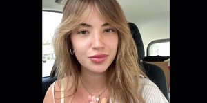 Η 26χρονη Σιέρα Κάνον ονειρευόταν πάντα να αποκτήσει φακίδες