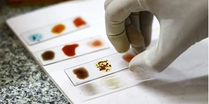 Το πιο σπάνιο αίμα στον κόσμο μοιάζει σχεδόν με μύθο – κι όμως κυκλοφορεί σε ελάχιστες φλέβες σε ολόκληρη την υφήλιο / SHUTTERSTOCK