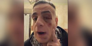 Ιταλός YouTouber 