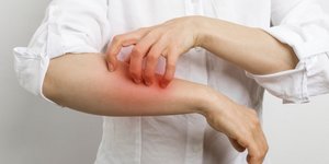 Τι είναι η ψώρα, πώς μεταδίδεται και πώς αντιμετωπίζεται