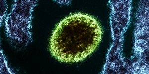 Σωματίδιο του ιού Νίπα