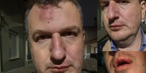 Άγριος ξυλοδαρμός του εκδότη της «ΜΑΓΝΗΣΙΑΣ» έξω από το σπίτι του στο Βόλο