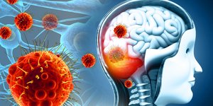 Aπεικόνιση της μηνιγγίτιδας στο ανθρώπινο σώμα