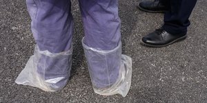 σακουλες στα ποδια