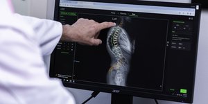 τεχνητή νοημοσύνη χειρουργική σπονδύλων