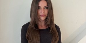 Η Αυστραλή influencer Κιμ Χάρτνετ υποβλήθηκε σε 3 πλαστικές επεμβάσεις στη μύτη