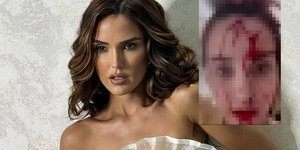 Η Μις Βενεζουέλα, Άντρεα ντελ Βαλδημοσίευσε βίντεο μετά την επίθεση από διάσημο στιλίστα