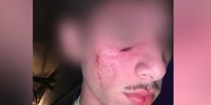 Επίθεση σε 16χρονο σε πανηγύρι στα Τρίκαλα
