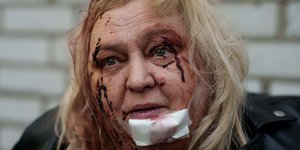 Η 65χρονη Ολένα Ντνιπρόβσκα κάθεται τραυματισμένη στην αυλή του κατεστραμμένου σπιτιού της στο Κίεβο, Τρίτη 2 Ιουνίου 2026. (AP Photo/Evgeniy Maloletka)