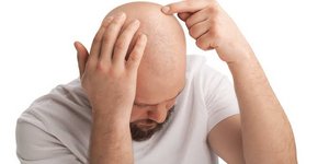 Λίγα πράγματα είναι τόσο συνηθισμένα στους άνδρες μέσης ηλικίας όσο το κλασικό receding hairline - αυτή η μικρή φαλάκρα που ολοένα και μεγαλώνει / UNSPLASH