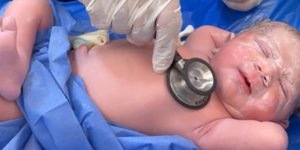 Νεογέννητο στην Αίγυπτο έγινε viral με την απίστευτα χαλαρή πόζα