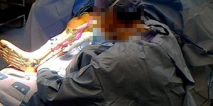φωτογραφίες: Χειρουργική επαυξημένης πραγματικότητας -Philip Pratt et al