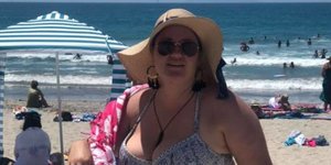 Η Shelley Proebstel /facebook/Bald and Beautiful