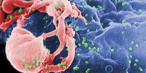 Επανάσταση κατά του AIDS: Νέα αντισώματα επιτίθενται στο 99% του ιού HIV/ Φωτογραφία: Cynthia Goldsmith/AP